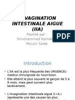 Invagination Intestinale Aigue (Iia)