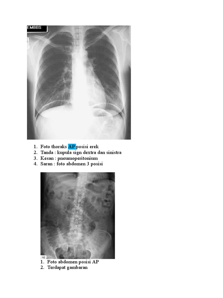 Hasil Foto Radiologi dan CT Scan | PDF | Sains & Matematika