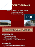 5 - Aula - Ecg - Sobrecarga de Camaras