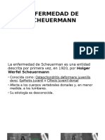 Enfermedad de Scheuermann