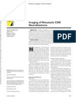 Metastasis CNS Neuroblastoma