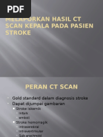 Peran CT Scan dalam Diagnosa Infark Cerebri | PDF | Seni