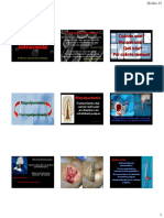 Medicação Intracanal T19