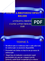 Tehnica bronhoscopiei rigide