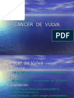 Cancer Vulva06