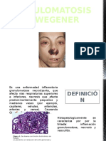 Granulomatosis de Wegener JL