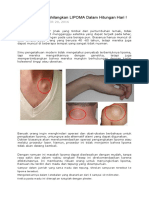 Cara Efektif Menghilangkan LIPOMA Dalam Hitungan Hari