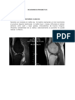 Irm Rodilla Quiste Baker