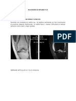 Irm Rodilla Derrame Articular