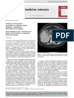 trombosis venosa profunda.pdf