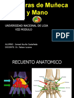 Fractura de Muñeca y Mano