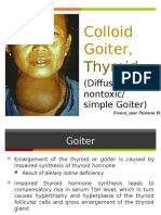 Colloid Goiter, Thyroid - Diffuse Nontoxic Simple Goiter