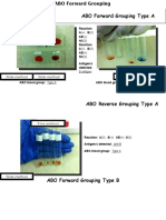 ABO Grouping BB Lab