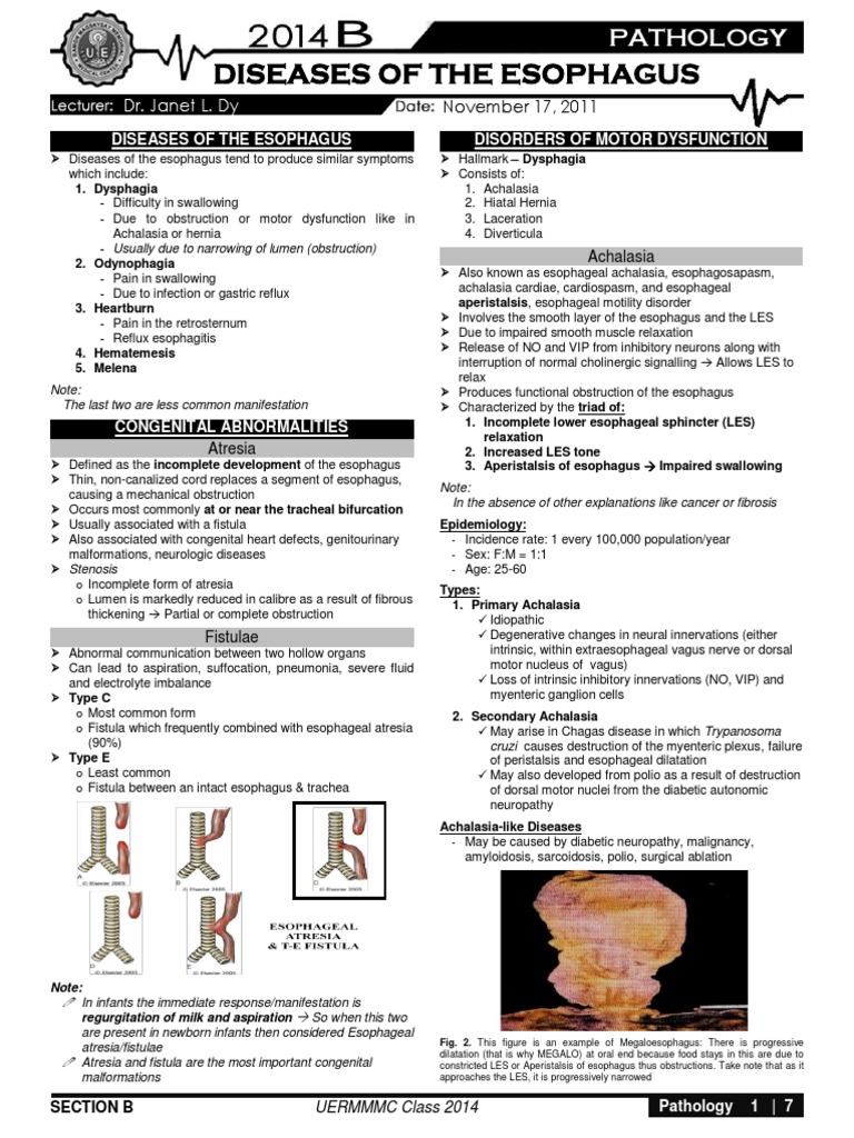Esophageal Disorders and Pathology Insights | PDF | Esophagus ...