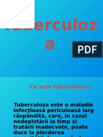 Tuberculoza