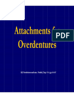 Attachments For Overdentures