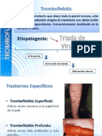 Tromboflebitis