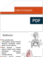 PNEUMOTHORAKS: Definisi, Etiologi, Patofisiologi, Klasifikasi, Gejala, Diagnosis dan Penatalaksanaan