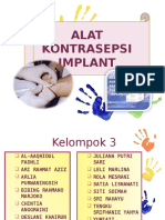 Alat Kontrasepsi Implan