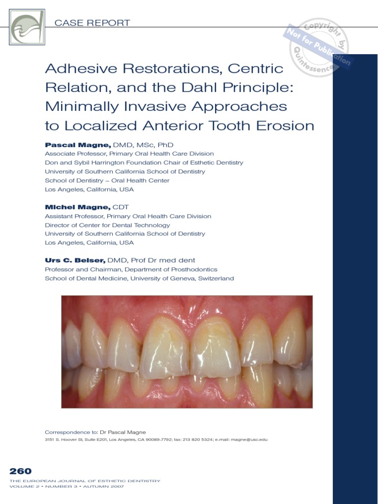 Adhesive Restorations Centric Relation Tooth Enamel Dental Composite