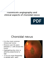 Fluorescein Angiography and Clinical Aspects of Choroidal Nevus