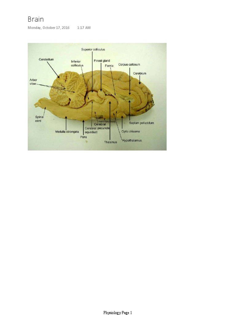 Cerebral Peduncle In Sheep A Comprehensive Guide - wbvm5ik