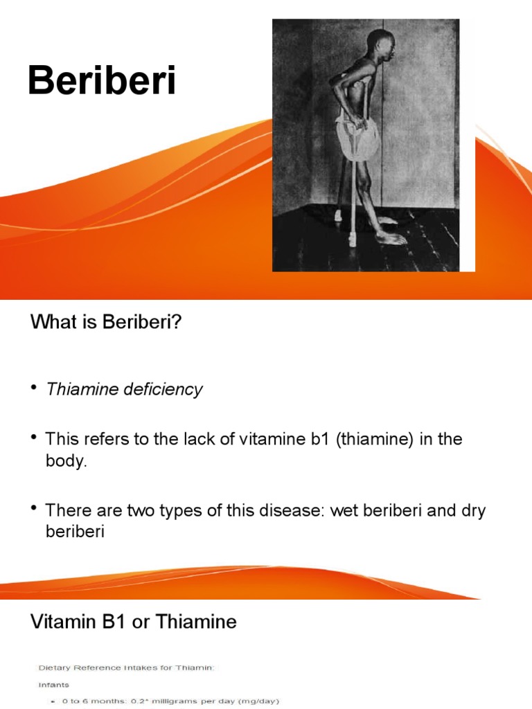 Beriberi | PDF