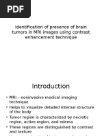 Brain Tumor MRI