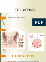 Tirotoxicosis