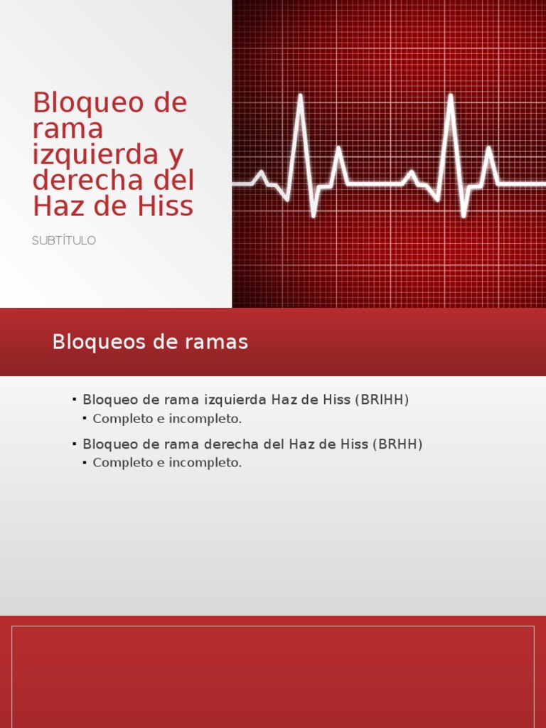 Bloqueo de Rama Izquierda y Derecha Del Haz