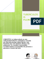 Tuberculosis Pulmonar.