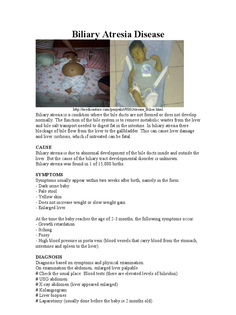 Biliary Atresia in Newborns | PDF | Wellness | Science & Mathematics