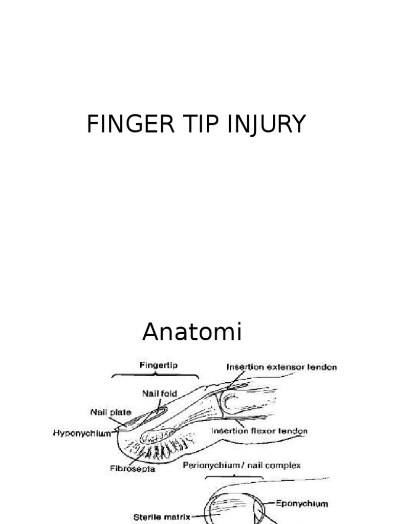 Finger Tip Injury | PDF