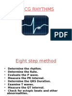 Basics ECG