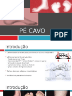 Pé Cavo: Fisiopatologia, Tipos, Exame e Tratamento