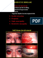 52thyroid Eye Disease