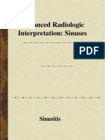 Radiologi Sinusitis