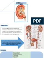 Uropatia Obstructiva