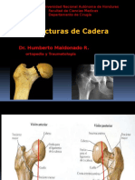 Fracturas de cadera: clasificación, epidemiología y tratamiento