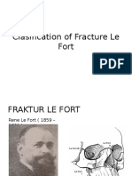 Clasification of Fracture Le Fort.pptx