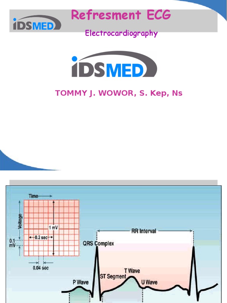 Unduh 91 Gambar Gelombang Ekg Normal  