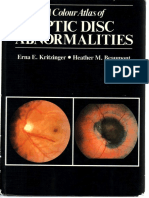 A Colour Atlas of Optic Disc Abnormalities - Kritzinger, Beaumont - 1987