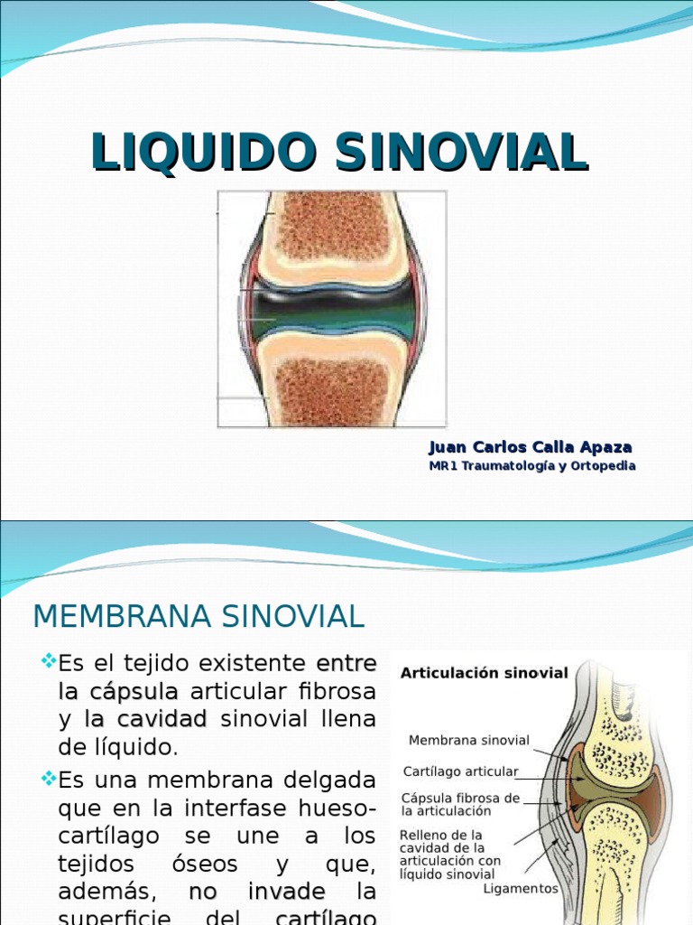 Liquido Sinovial Inflamación Citocina