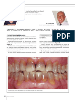 EnmascaramientoCarillas.pdf