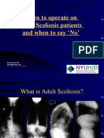 When To Operate On Adult Scoliosis Patients and When To Say No