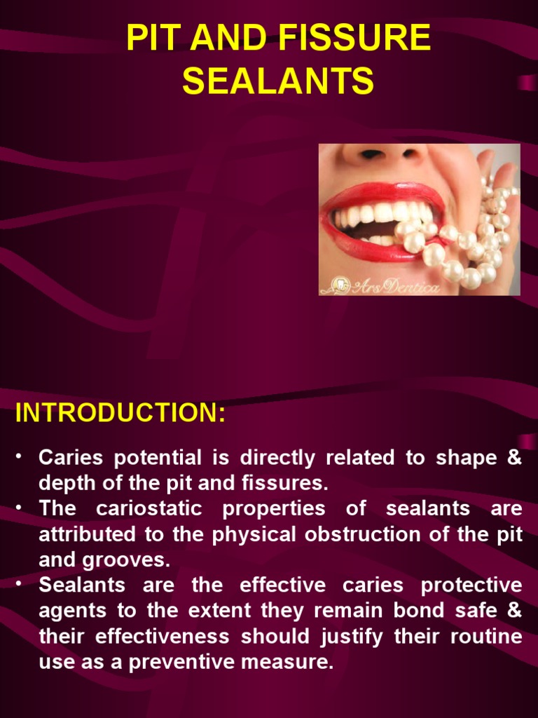 Pit and Fissure Sealants Ppt Dentistry Mouth