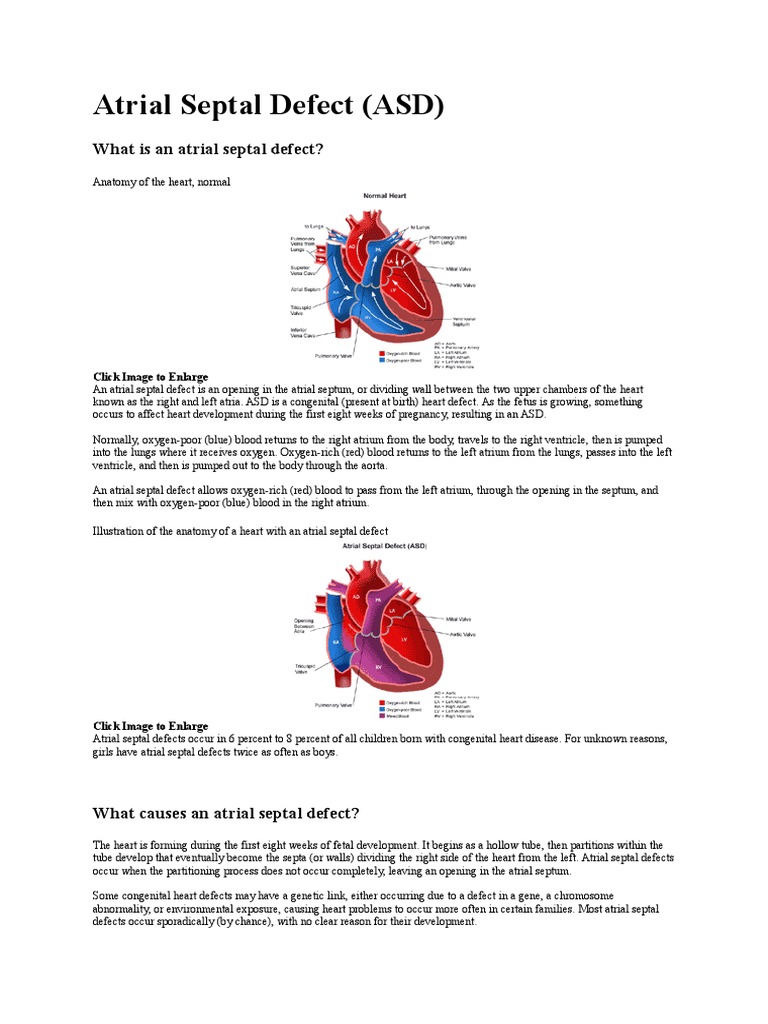 Atrial Septal Defect | PDF | Atrium (Heart) | Heart