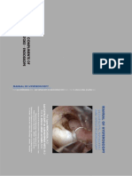 Manual of Hysteroscopy - Storz PDF