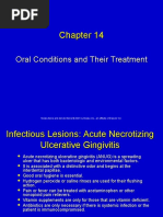 Tetracycline for eye infection bnf