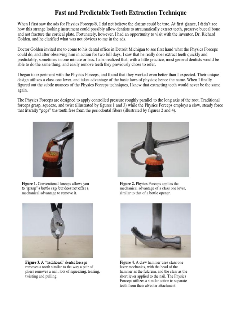 Technical Fast and Predicable Extraction-Final PDF | PDF | Human Tooth ...